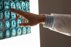 Brain Injury Lawyer in Cary, NC