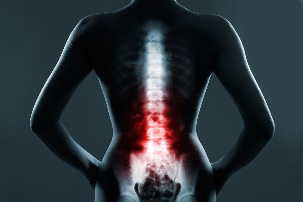 Back Injuries